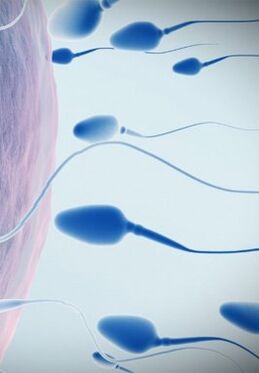 düşük güçte spermogram
